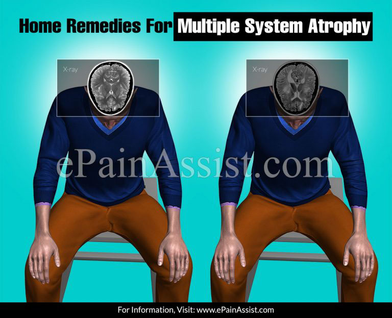 Home Remedies For Multiple System Atrophy