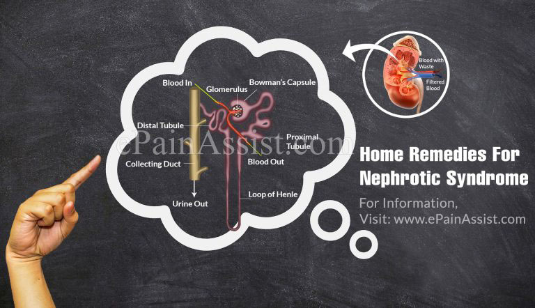 Home Remedies For Nephrotic Syndrome
