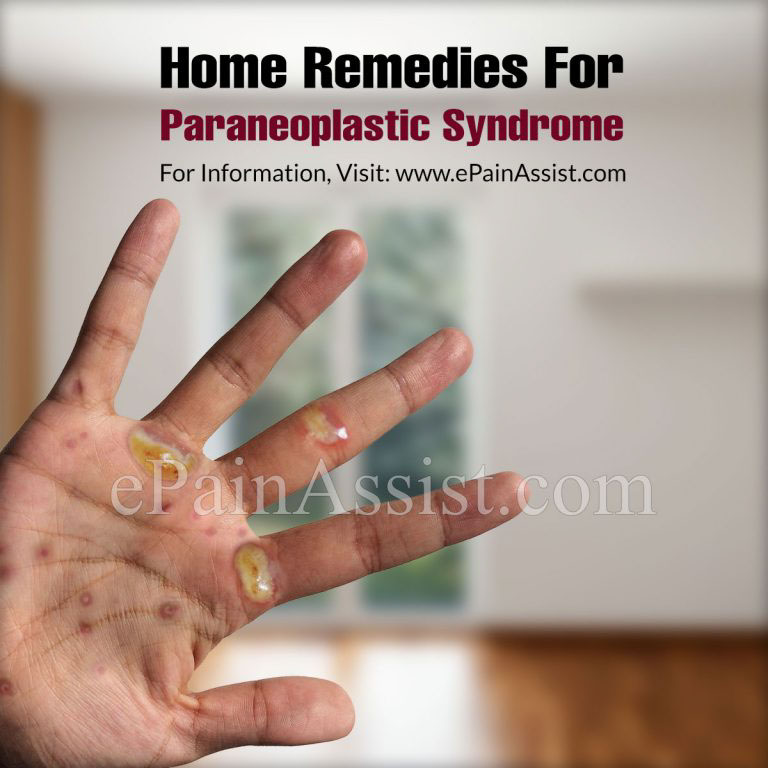 Home Remedies For Paraneoplastic Syndrome