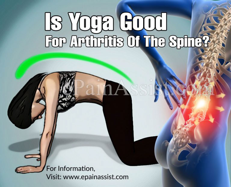 Is Yoga Good For Arthritis Of The Spine?