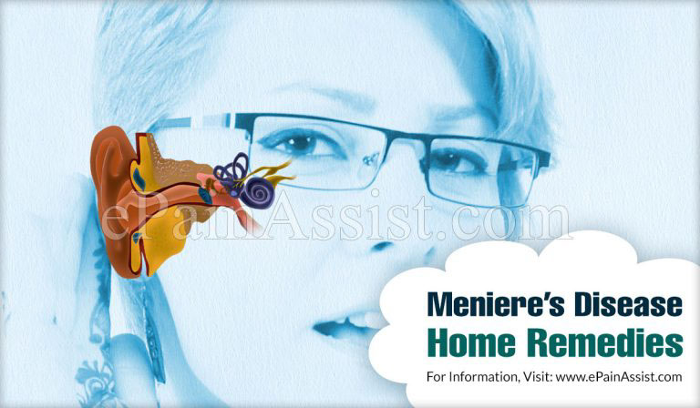 Meniere’s Disease Home Remedies
