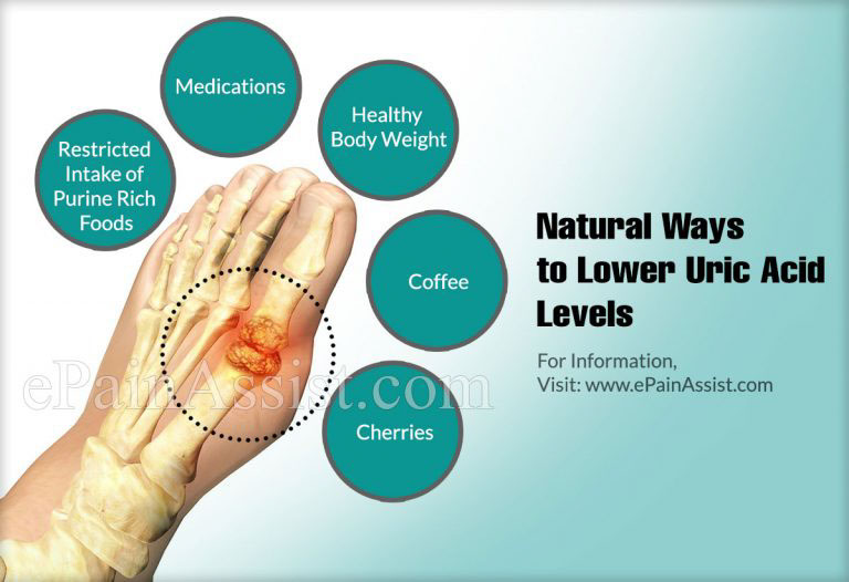 Natural Ways to Lower Uric Acid Levels