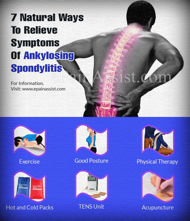 7 Natural Ways To Relieve Symptoms Of Ankylosing Spondylitis