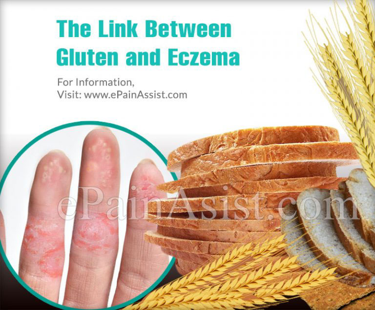 The Link Between Gluten and Eczema
