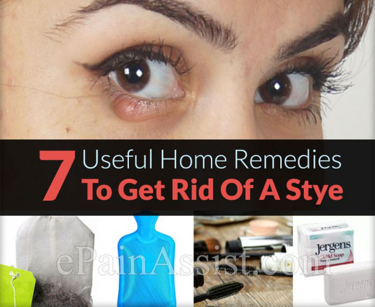 7 Useful Home Remedies To Get Rid Of A Stye
