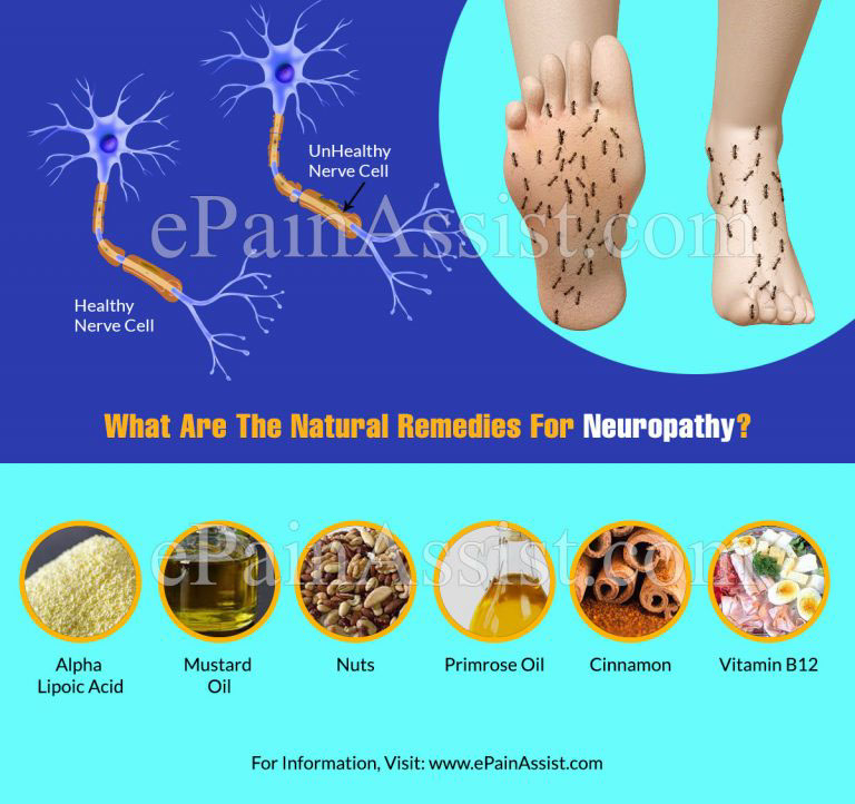 What Are The Natural Remedies For Neuropathy?