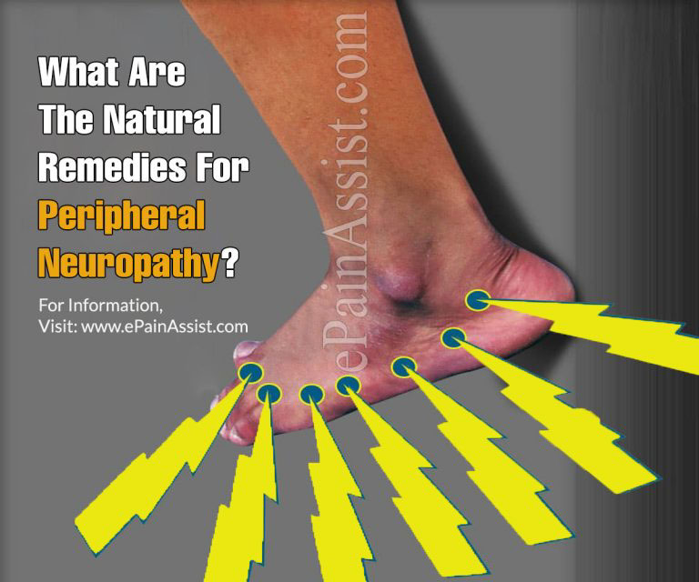 What Are The Natural Remedies For Peripheral Neuropathy?