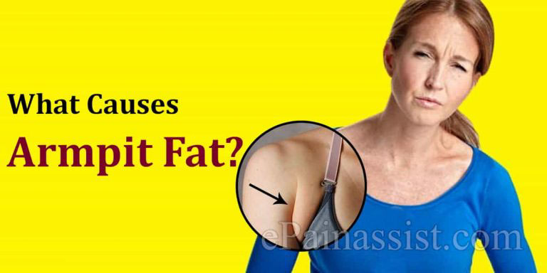 What Causes Armpit Fat & How To Reduce It?