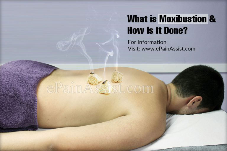 What is Moxibustion & How is it Done?