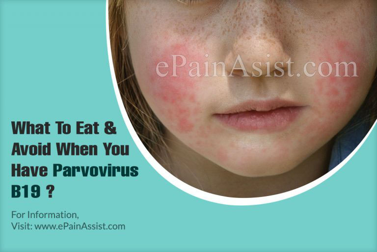 What To Eat & Avoid When You Have Parvovirus B19 & Coping Methods For It?