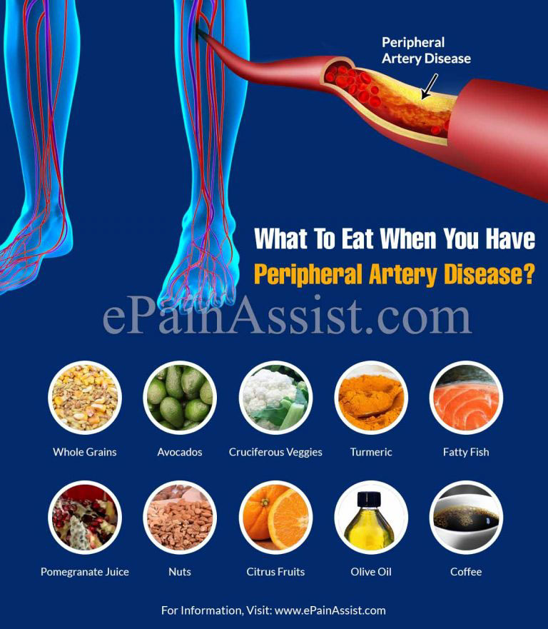 What To Eat & Avoid When You Have Peripheral Artery Disease?