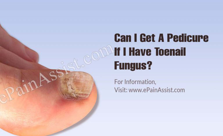 Can I Get A Pedicure If I Have Toenail Fungus?
