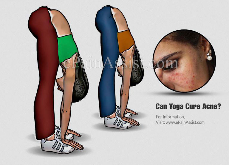 Can Yoga Cure Acne?
