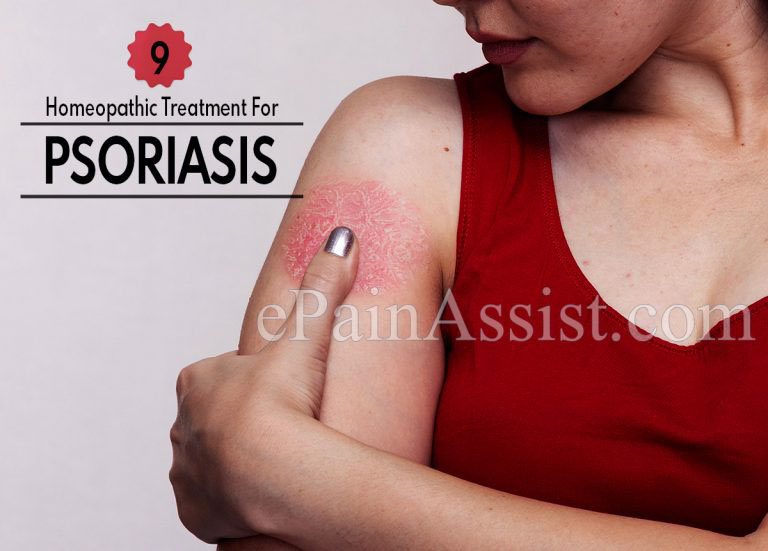 9 Effective Homeopathic Treatment For Psoriasis