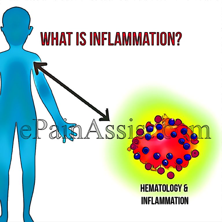 Understanding Inflammation and the Anti-Inflammatory Diet: How to Manage Symptoms and Reduce Risk of Chronic Diseases With Diet