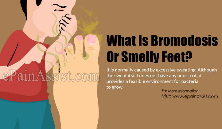 Bromodosis Or Smelly Feet: Causes, Symptoms, Treatment