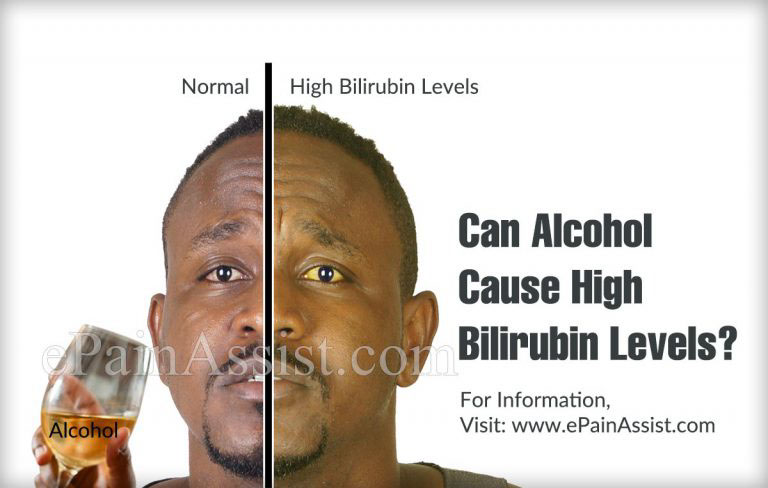 Can Alcohol Cause High Bilirubin Levels?