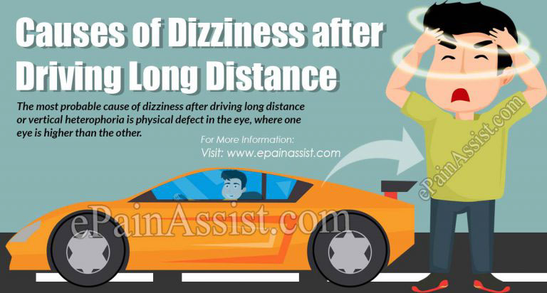Causes of Dizziness After Driving Long Distance, Its Symptoms, Management