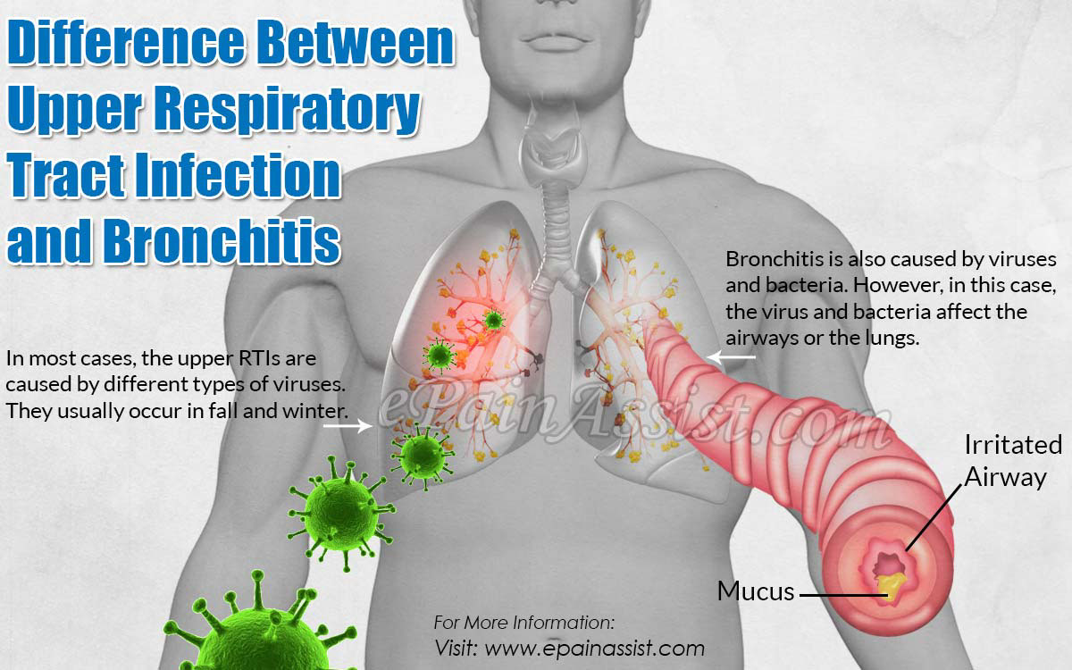 Difference Between Upper Respiratory Tract Infection and Bronchitis