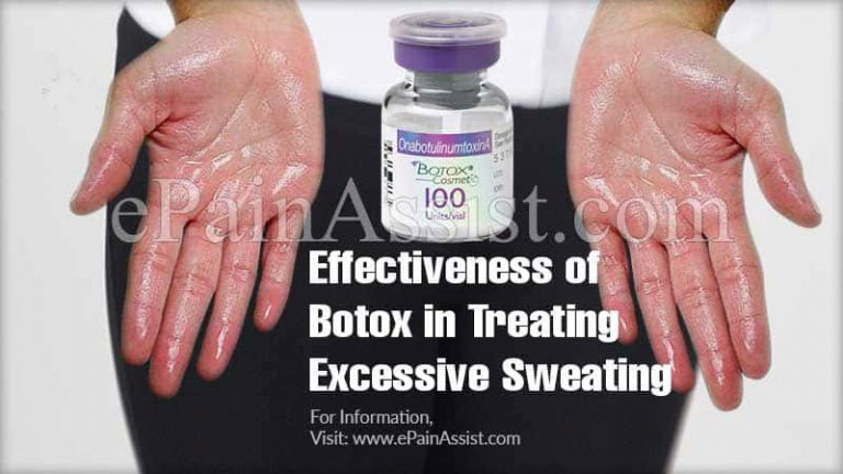 Effectiveness of Botox in Treating Excessive Sweating & Its Side Effects