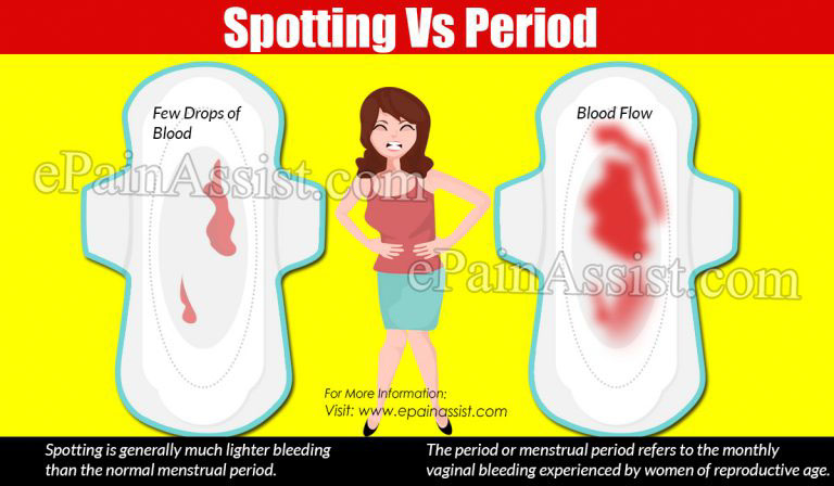 Spotting Vs Period : Differences Based on Causes, Symptoms, Treatments