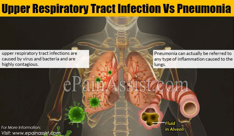 Upper Respiratory Tract Infection Vs Pneumonia : Differences Based on Causes, Symptoms, Treatment