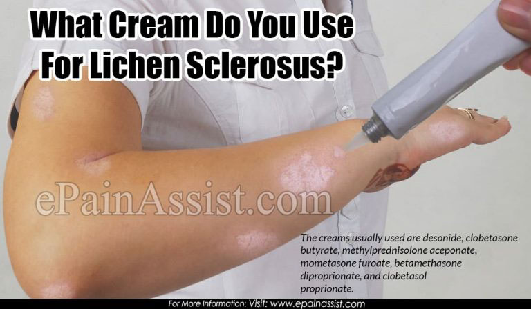 What Cream Do You Use For Lichen Sclerosus?