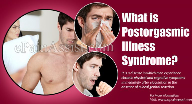 What is Postorgasmic Illness Syndrome: Causes, Symptoms, Treatment, Prognosis
