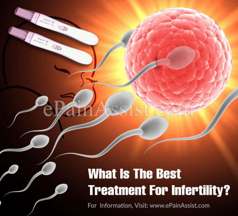 What Is The Best Treatment For Infertility?