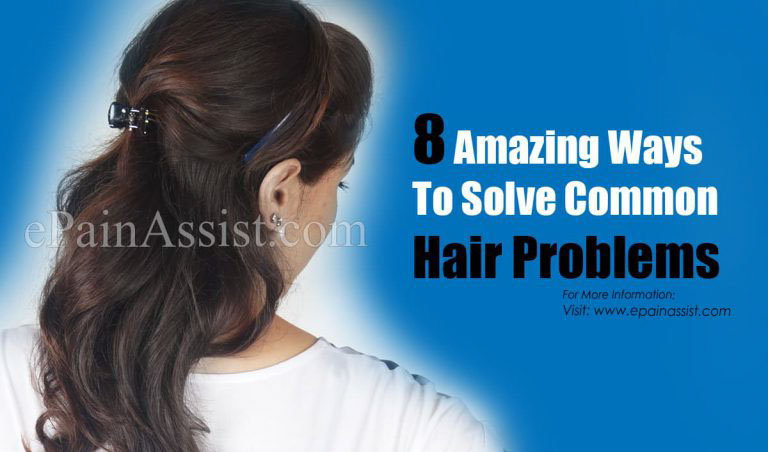 8 Amazing Ways To Solve Common Hair Problems
