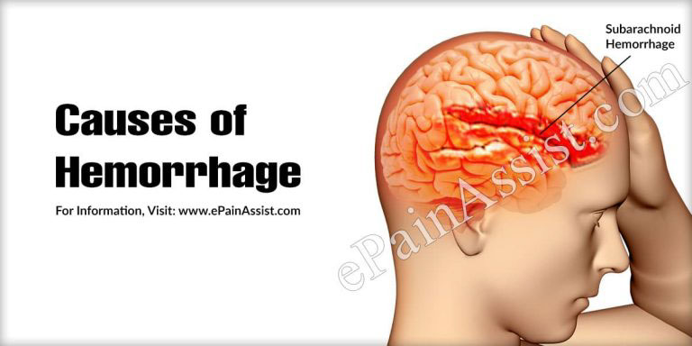 Hemorrhage: Causes, Emergency Symptoms, Treatment, Consequences of Untreated Hemorrhage