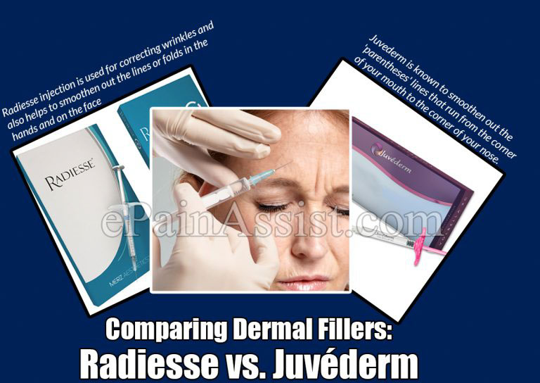 Comparing Dermal Fillers: Radiesse vs. Juvéderm