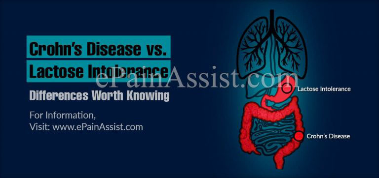 Crohn’s Disease vs. Lactose Intolerance : Differences Worth Knowing