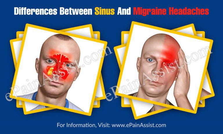 Differences Between Sinus And Migraine Headaches