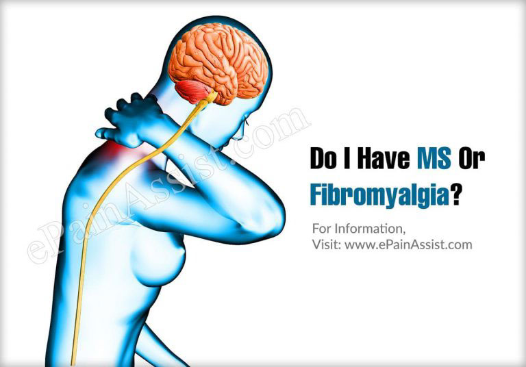 Do I Have MS Or Fibromyalgia?