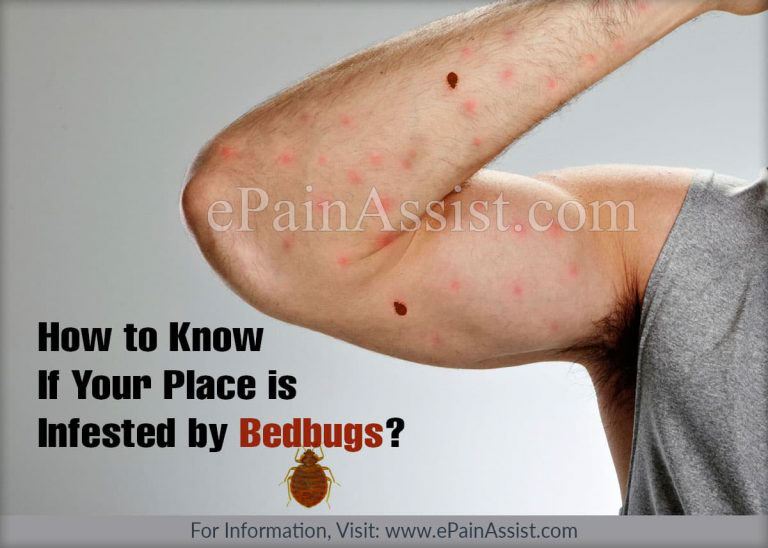 How to Know if Your Place is Infested by Bedbugs & Ways to Get Rid of Bedbugs?
