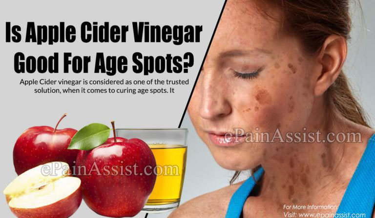 Is Apple Cider Vinegar Good For Age Spots?