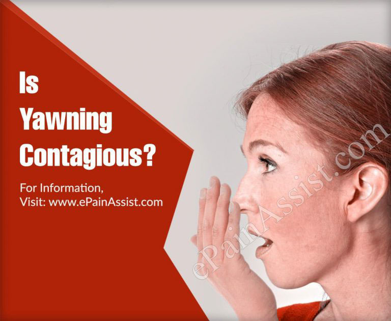 Is Yawning Contagious