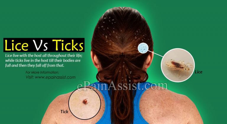 Lice Vs Ticks : Differences Based on Classification, Anatomy, Life Cycle, Behavior & Habitat