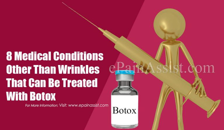 8 Medical Conditions Other Than Wrinkles That Can Be Treated With Botox