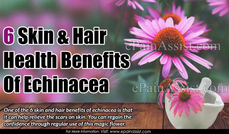 6 Skin & Hair Health Benefits Of Echinacea