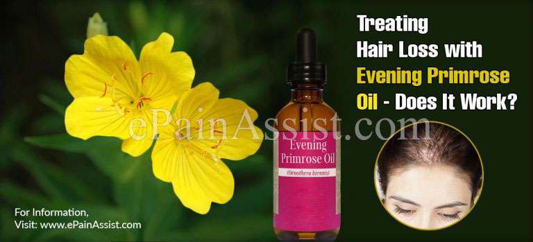 Treating Hair Loss with Evening Primrose Oil – Does It Work?