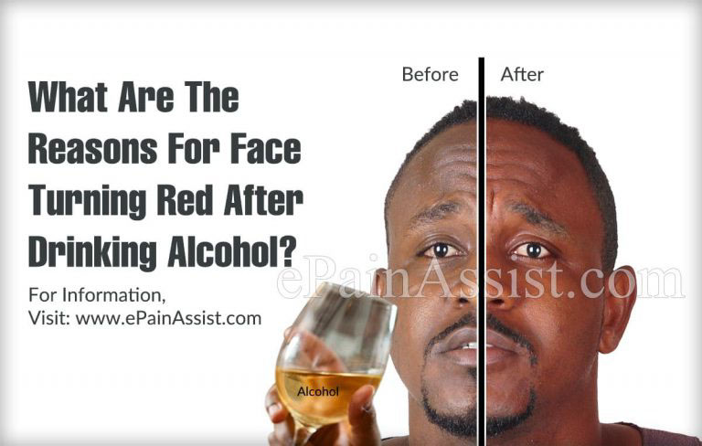 What Are The Reasons For Face Turning Red After Consuming Alcohol?