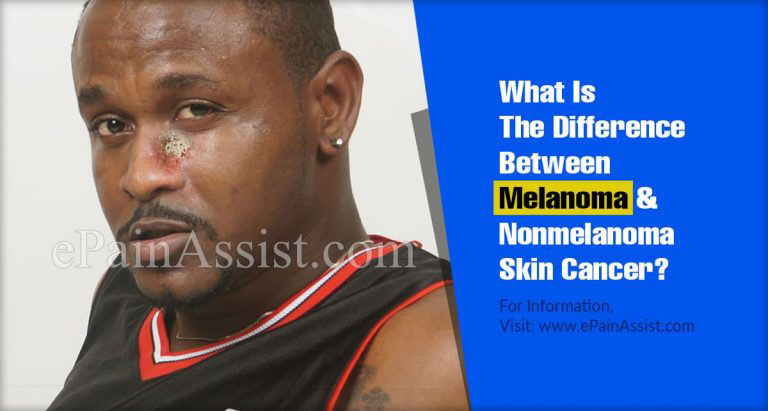 What Is The Difference Between Melanoma & Nonmelanoma Skin Cancer?