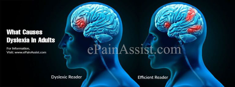 What Causes Dyslexia In Adults & How To Manage The Condition?