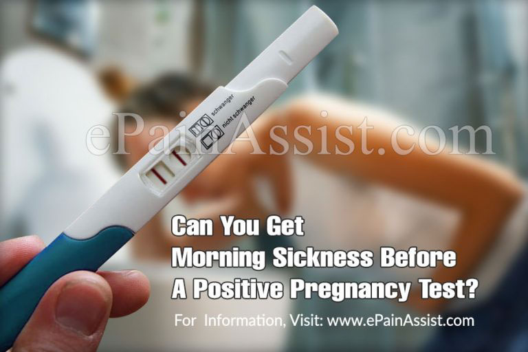 Can You Get Morning Sickness Before A Positive Pregnancy Test?