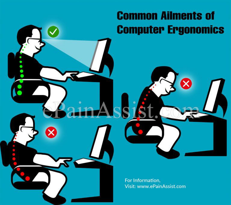 Computer Ergonomics: Exercises and Ways to Protect Yourself from Strain and Pain?