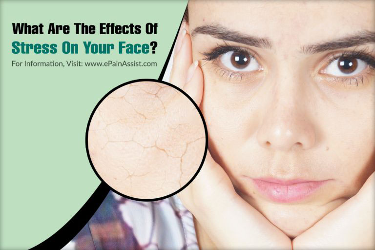 What Are The Effects Of Stress On Your Face?