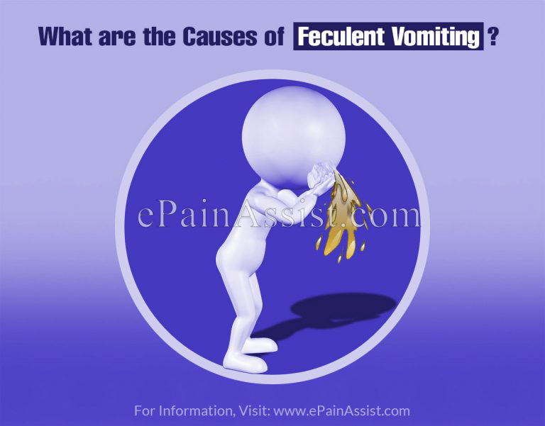 Feculent Vomiting: Can You Vomit Poop?