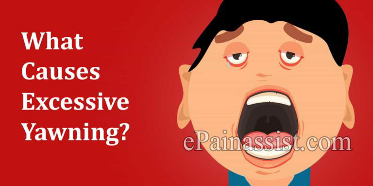 What Causes Excessive Yawning And How To Deal With It?